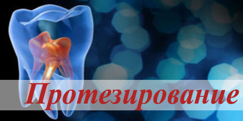 протезирование
